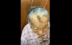 Cụ bà 107 tuổi bỗng mọc sừng trên trán, cộng đồng mạng bàn tán đưa ra lời khuyên